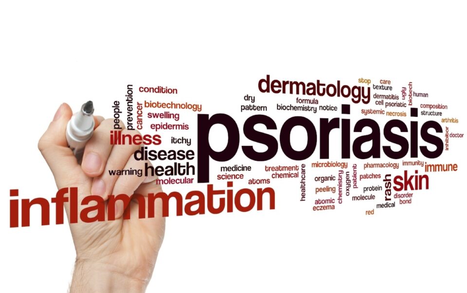 Can You Receive Disability Benefits for Psoriasis?